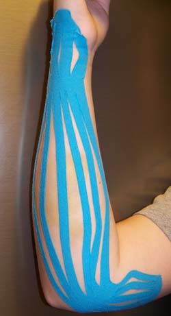 kinesio tape arm-elbow