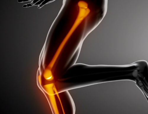 Considering a Hip or Knee Replacement? Read On!